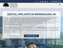 Tablet Screenshot of dentalimplantsinbirminghammi.com